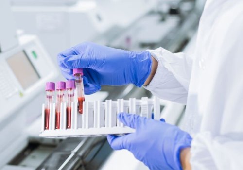 Laboratoriyada emekdasliq: tebabetde kesflere aparan yol